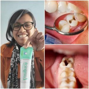 Dentifrices LONGRICH